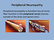 What is it Peripheral Neuropathies - Causes Symptoms & Treatment