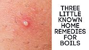 Home Remedies for Boils: Three Little Known Home Remedies for Boils