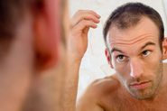How do I know if I'm a Candidate for a Hair Transplant?