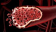 9 aplicaciones directas de la impresión 3D en medicina