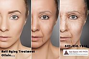7 Questions- Ask before agreeing to any surgical procedure | Cosmetic Surgeons | Skin Care | Anti-Aging Tip | Stretch...
