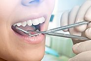 How Myobrace Melbourne Experts offer treatment for Teeth Straightening for Kids?