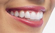 Why People Prefer to use Invisalign in Burwood?