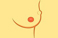 Lump in Breast: Pain, Location, Bump, Breast Cancer