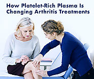 How Platelet-Rich Plasma Is Changing Arthritis Treatments | Dr PRP USA