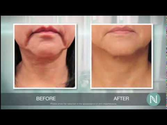 Eliminate Hyperpigmentation | Use This Hyperpigmentation Treatment ~ Get Results ~