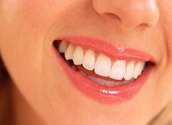 Dr Simon Darfoor - Teeth Whitening Treatment