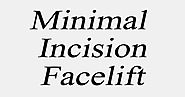 Minimal Incision Facelift | Minimal Incision Surgery | Mini Facelift Chicago