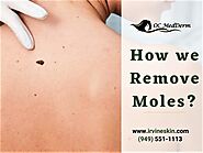 Best mole removal dermatologist in California