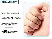 Nail Conditions, Disorders & Treatments | OC MedDerm