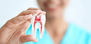 Painless RCT - Root Canal Treatment | Painless RCT in Delhi