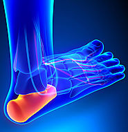 HC Ortho - surgical and non-srugical plantar fasciitis treatments