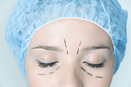 Shape Up Your Eyelids with blepharoplasty surgery | Eyelid Surgery