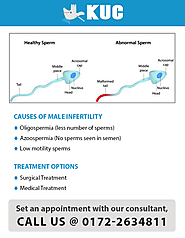 Causes of Male Infertility | Treatment option