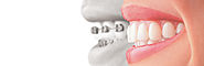 Dandenong Orthodontics | Orthodontist Dandenong