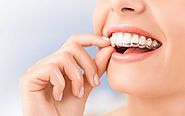 Invisalign Burwood Dental Correction Services Offered For Teeth Misalignment