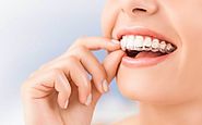 Care Your Kid's Teeth With Invisalign Burwood: Detailed Information