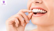 What Things you should know prior to have the Invisalign Burwood Treatment?
