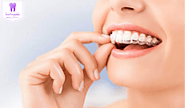 How Does Invisalign Oakleigh Take Place and How is the Treatment?