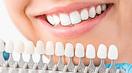 Canoga Park Cosmetic Dentistry | The Dental Cottage