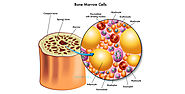 All you need to know about Bone Marrow Transplant in India - INDHEAL