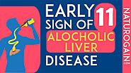 11 Early Signs of Alcoholic Liver Disease