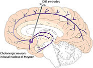 Best neurosurgery specialist in Chandigarh, Neurosurgery Specialist Near Me