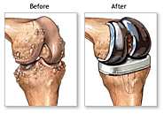 Famous Knee Problem Specialist in Ahmedabad - Book Appointment Online