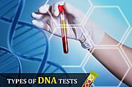 Brief details of DNA Testing Ancestry