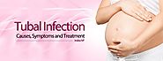 Tubal Infection : Causes, Symptoms and Treatment - indiraivf