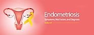 Endometriosis : Symptoms, Causes And Treatment - Indira IVF