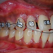las vegas orthodontics