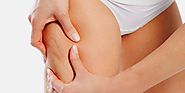 Cellulite Removal - Causes, Treatment, Symptoms & Tips
