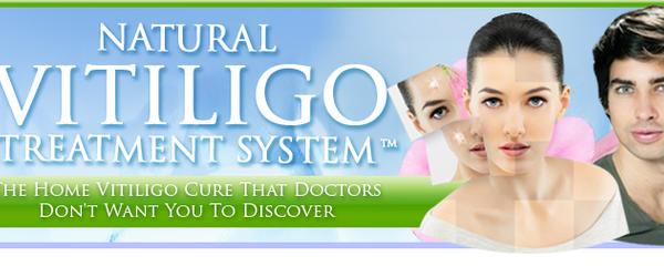 Headline for Cure Vitiligo 2014