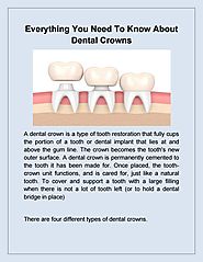 Dentist Brandon: Everything Need to know About Dental Implant | Bridges Dental by Laura Coyle Bridges - Issuu