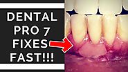 Where can I buy dental pro 7 to finally cure my Gum problems LIGHTNING fast (2018)