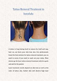 Tattoo removal treatment