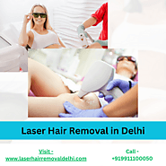 Laser Hair Removal for Men - A Complete Guide