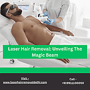 Laser Hair Removal: Unveiling The Magic Beam
