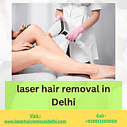 Unveiling the Secrets of Laser Hair Removal: Your Go-To Solution for Smooth Skin in Delhi!