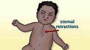 "Recognizing Respiratory Distress" by Monica Kleinman, MD for OPENPediatrics
