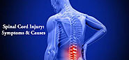 Spinal Cord Injury | Medmonks