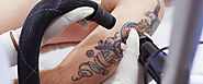 Dew Skin Clinic- Tattoo removal Clinic, Birthmark removal, Chemical Peeling treatment, Acne spot Removal Clinic, Skin...
