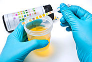 What the Color of Your Urine May Indicate