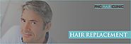 Hair replacement in Noida