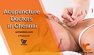 Acupuncture doctors in Chennai | Acupuncture in Chennai