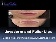 Juvederm and Fuller Lips