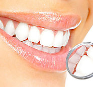 Cosmetic Dentistry | Dental Implants | Dentistree | Melbourne