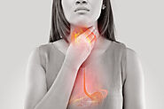 What to Do About GERD (Gastroesophageal Reflux Disease)