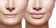 Do You Know About Lip Fillers And How It Makes A Perfect Look - Daminga